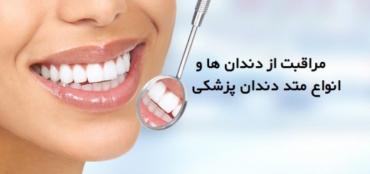 مراقبت از دندان ها و انواع متد دندان پزشکی