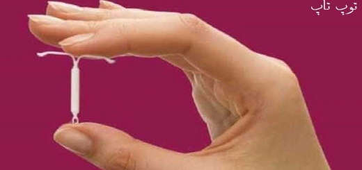 ایرادات و عوارض جانبی استفاده از IUD برای پیشگیری از بارداری