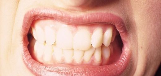 بررسی علل دندان قروچه در بزرگسالان و کودکان