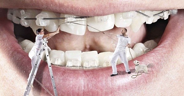 متدهای دندانپزشکی