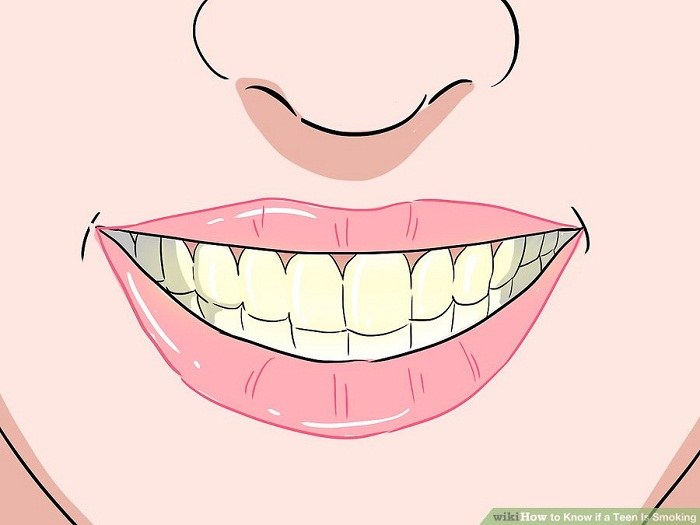 توجه به دندان های در حال زرد شدن