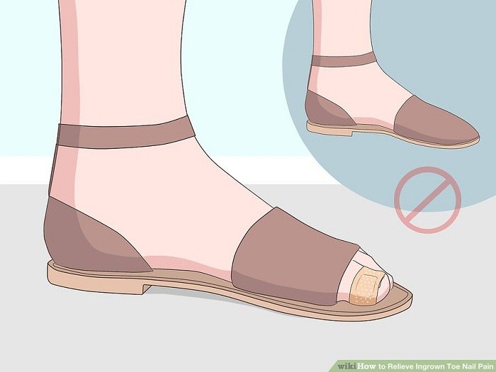 پوشیدن کفش تابستانی یا گشاد