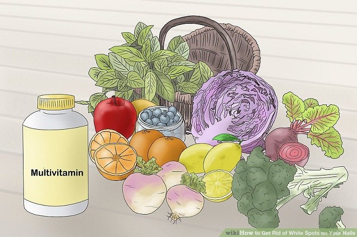 درمان لکه های سفید ناخن با تغییرات در سبک زندگی