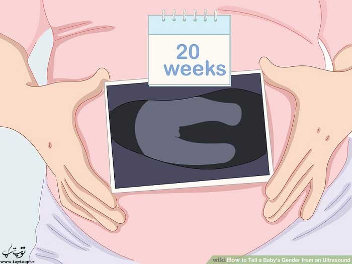 انتظار برای مشخص شدن جنسیت نوزاد در هفته بیستم سونوگرافی